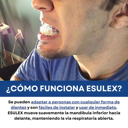 NightEase™|Protector Bucal Antirronquidos Moldeable- Tamaño Universal